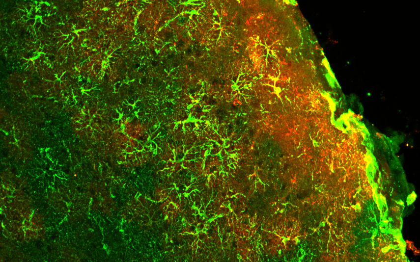 Dissociation between hemodynamic and metabolic responses to chemogenetic modulation of astrocytes in mouse visual cortex