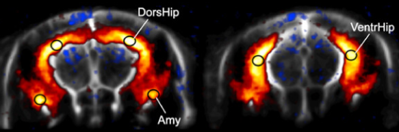 Minute- and second-scale hippocampal network dysfunctions in the 3xTgAD mouse model of Alzheimer’s disease are prevented by TSPO knockout