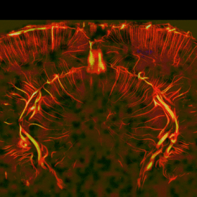 Induction of haemodynamic travelling waves by glial-related vasomotion in a rat model of neuroinflammation: implications for functional neuroimaging