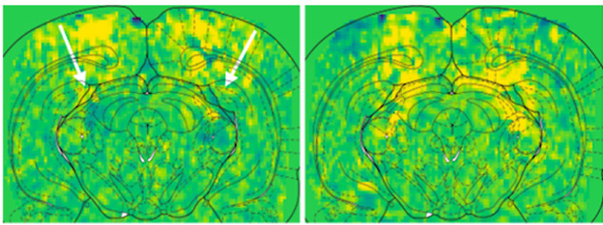 Induction of haemodynamic travelling waves by glial-related vasomotion in a rat model of neuroinflammation: implications for functional neuroimaging